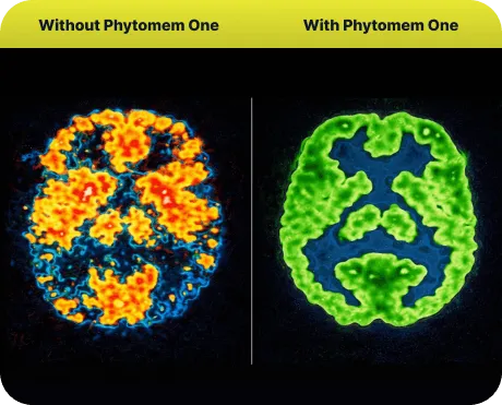 Illustration of brain health before and after consistent Phytomem One use